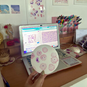 Aquarela - Plasmodium em eritrócitos